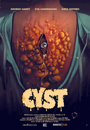 Киста (2020) Постер
